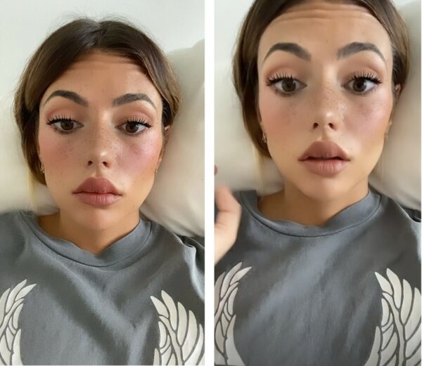 Social Media Filters A Cause of Body Dysmorphia or Just A Form of